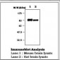 PRKCE / PKC-Epsilon Antibody